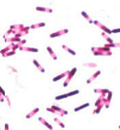 proteus vulgaris gram stain