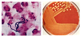 A streptococcus spp kenetben férfiakban)