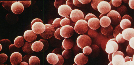 Staphylococcus aureus bacteria.